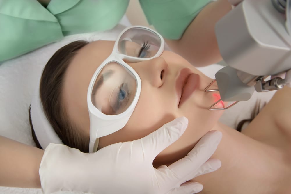 CO2 Laser Treatment Chennai | Skin Resurfacing Services Tamilnadu