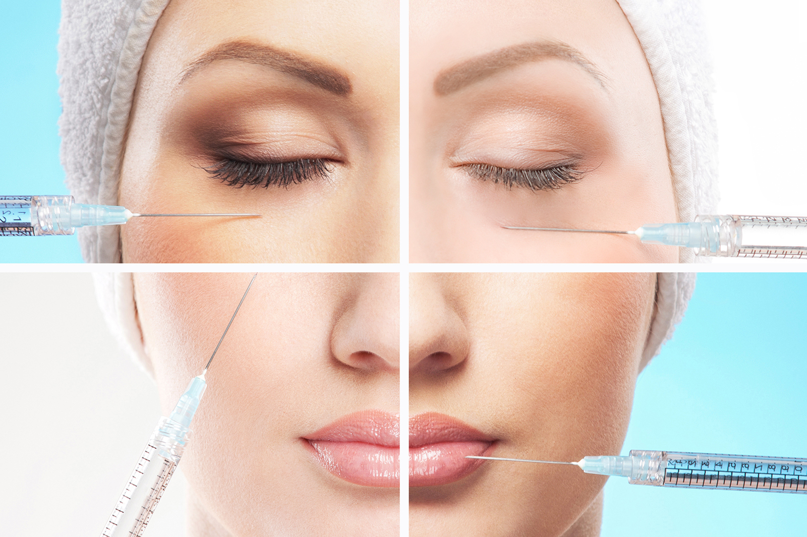 dermal-fillers